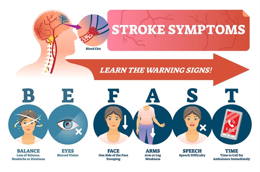 Stroke symptoms BE FAST chart