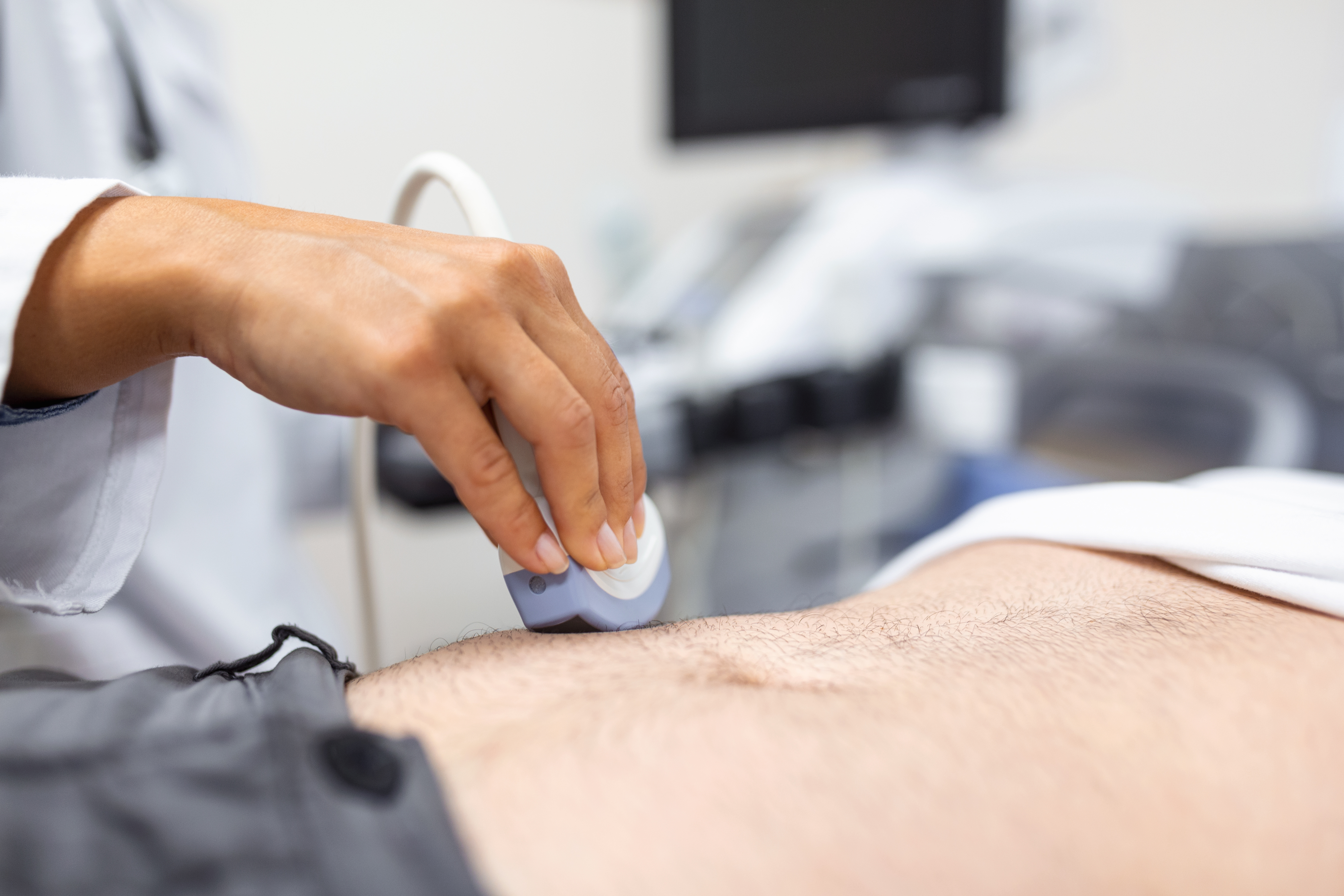 Diagnóstico por ultrasonido del estómago en la cavidad abdominal de un hombre en la clínica, vista en primer plano. El médico pasa un sensor de ultrasonido sobre el abdomen del paciente.