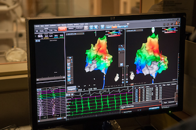 Protime heart rhythm